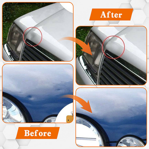 Image showing the components of the dent puller kit