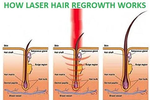 Using the Professional Hair Regrowth Laser Comb