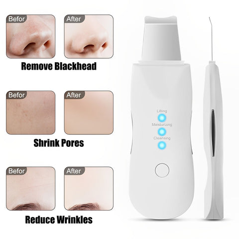 Ultrasonic skin scrubber removing impurities from skin